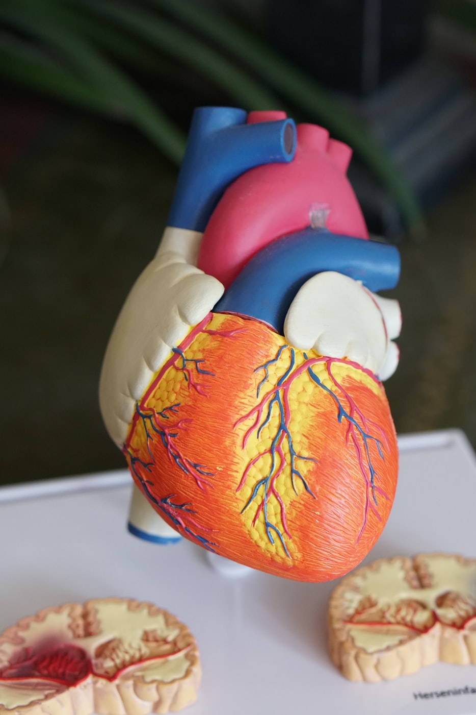 Un nou transplant de inimă, la Institutul de Boli Cardiovasculare şi Transplant din Târgu Mureş